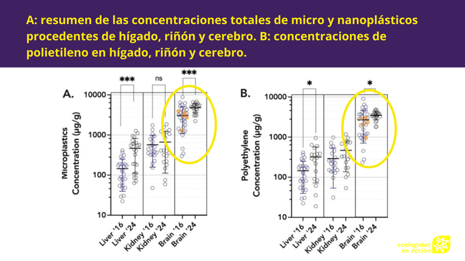 microplásticos en el cerebro